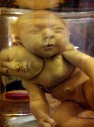 This is a two headed baby in a jar.